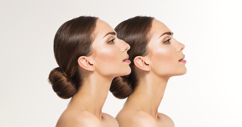 Imagem Post Rinoplastia
